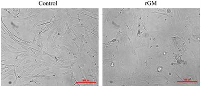 Circular RNAs are associated with the resistance to Newcastle disease virus infection in duck cells